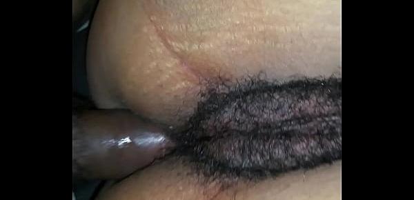  Hairy skank anal pussy swap